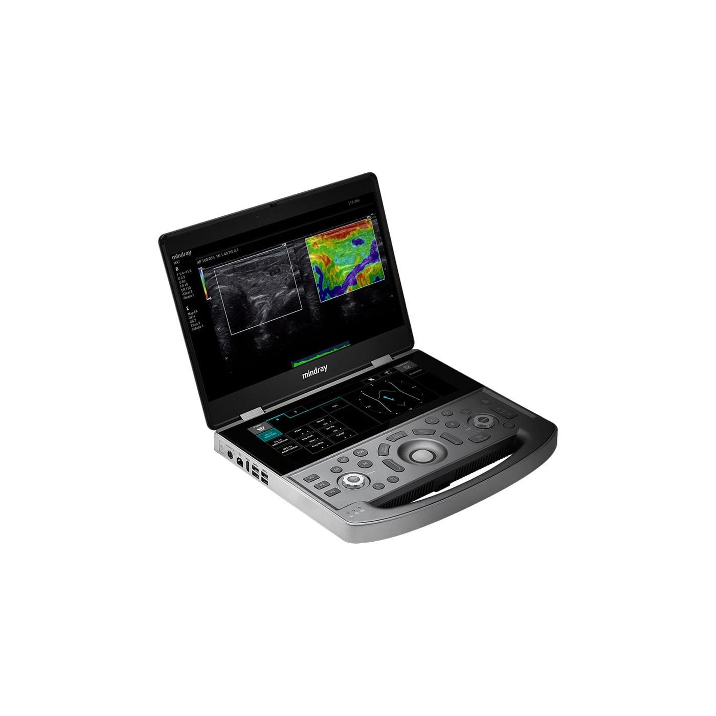 Портативный УЗИ аппарат Mindray MX8 Exp