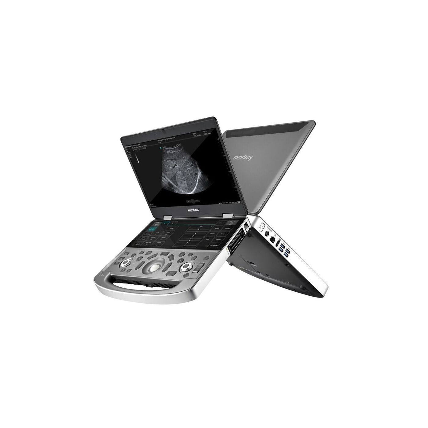 Портативный УЗИ аппарат Mindray MX8