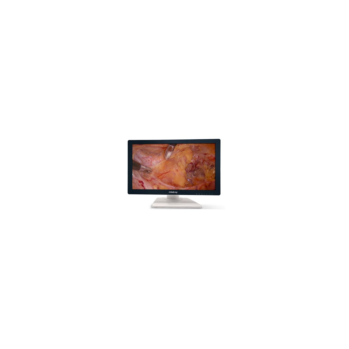 Эндоскопическая видеосистема Mindray HD-3