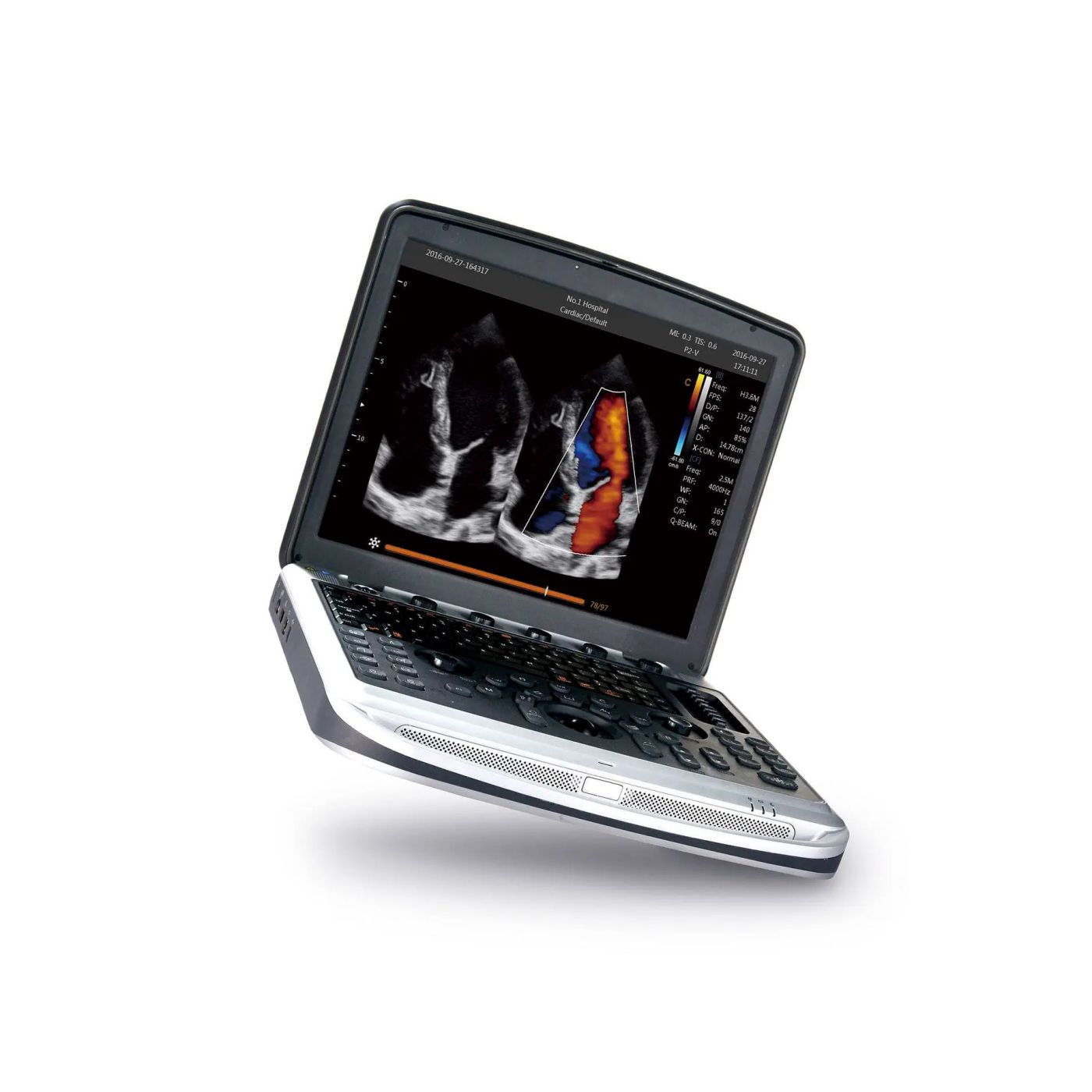 УЗИ аппарат CHISON SonoBook 9