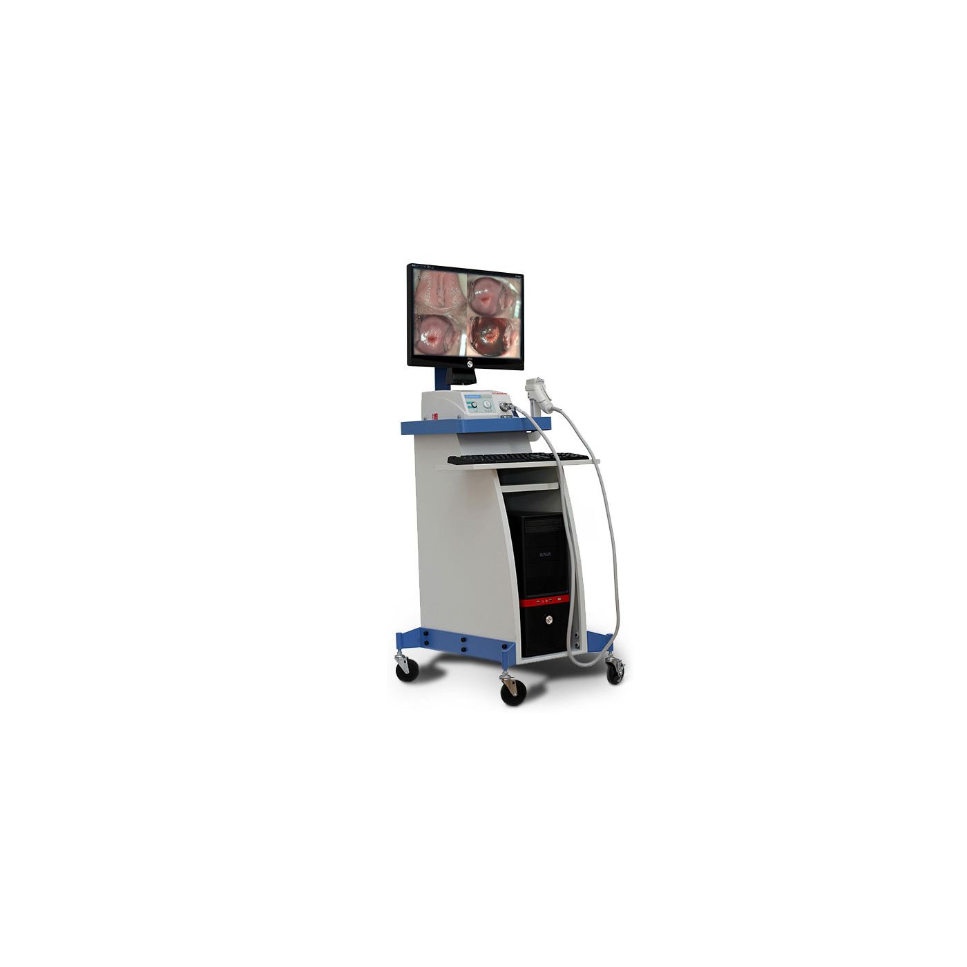 Видеокольпоскоп Medonica Dr. Camscope DCS-102 Pro