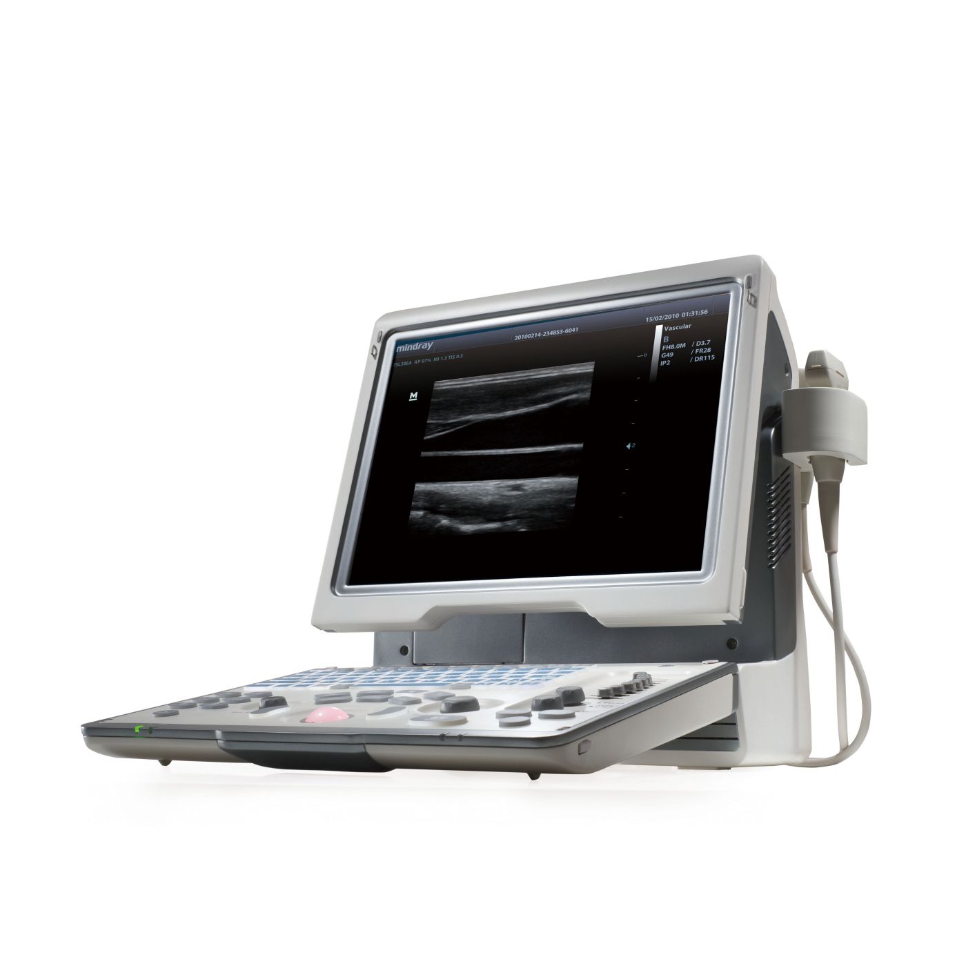 УЗИ аппарат Mindray DP-50