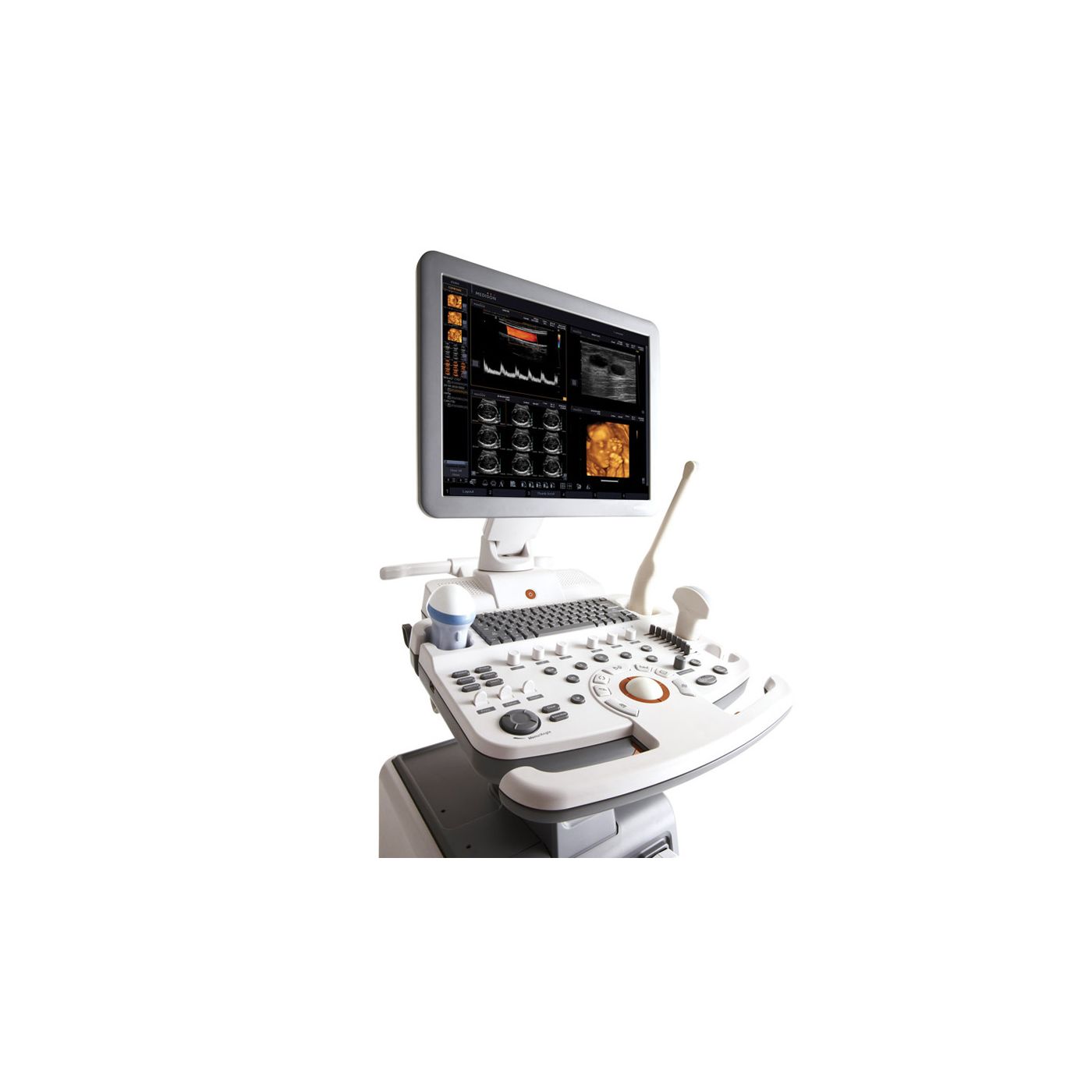 УЗИ аппарат Samsung SonoAce R7
