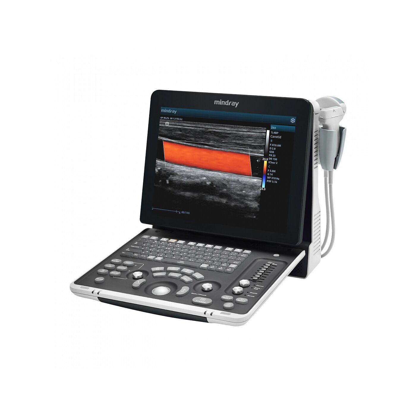 УЗИ сканер Mindray Z60 Exp