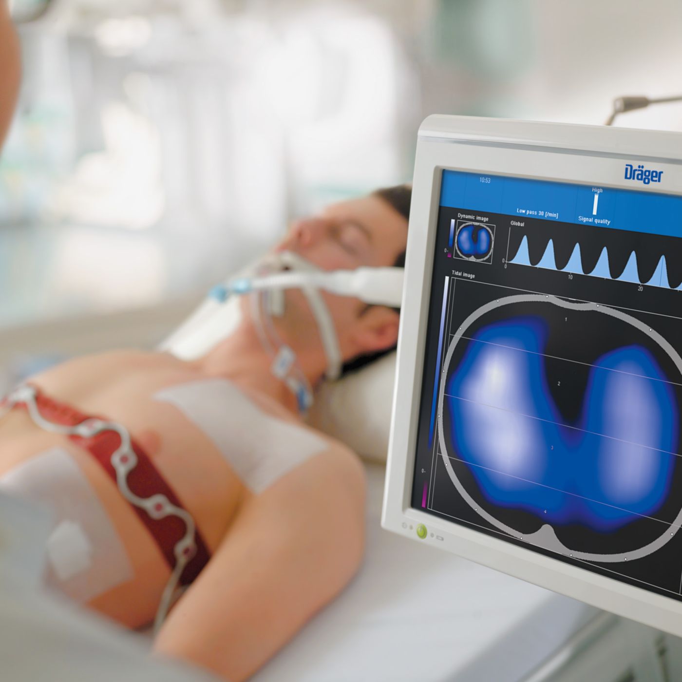 Dräger PulmoVista 500 Система электро-импедансной визуализации легких